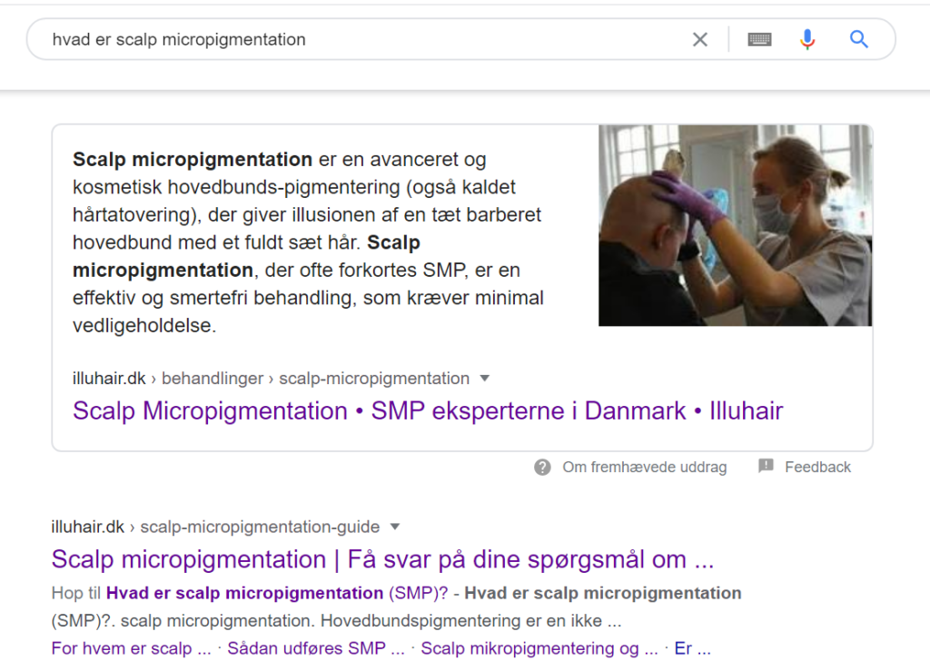 Søgning på scalp micropigmentation